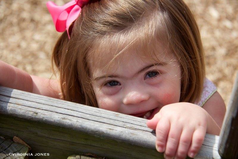 FAQ: How to welcome a baby with Down syndrome - Today's Parent